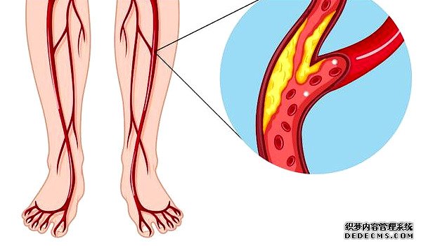 硒对身体有多重要,您知道吗?哪些食物富含硒元素呢?医生告诉您
