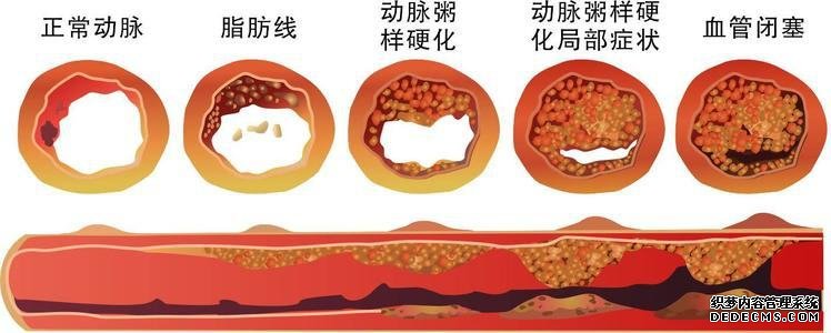 45-55岁，生命中的关键10年，做好4件事，延长寿命并不难