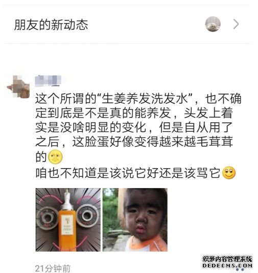 防脱干货，真实经历分享！如何战胜脱发，本文总结多种方法