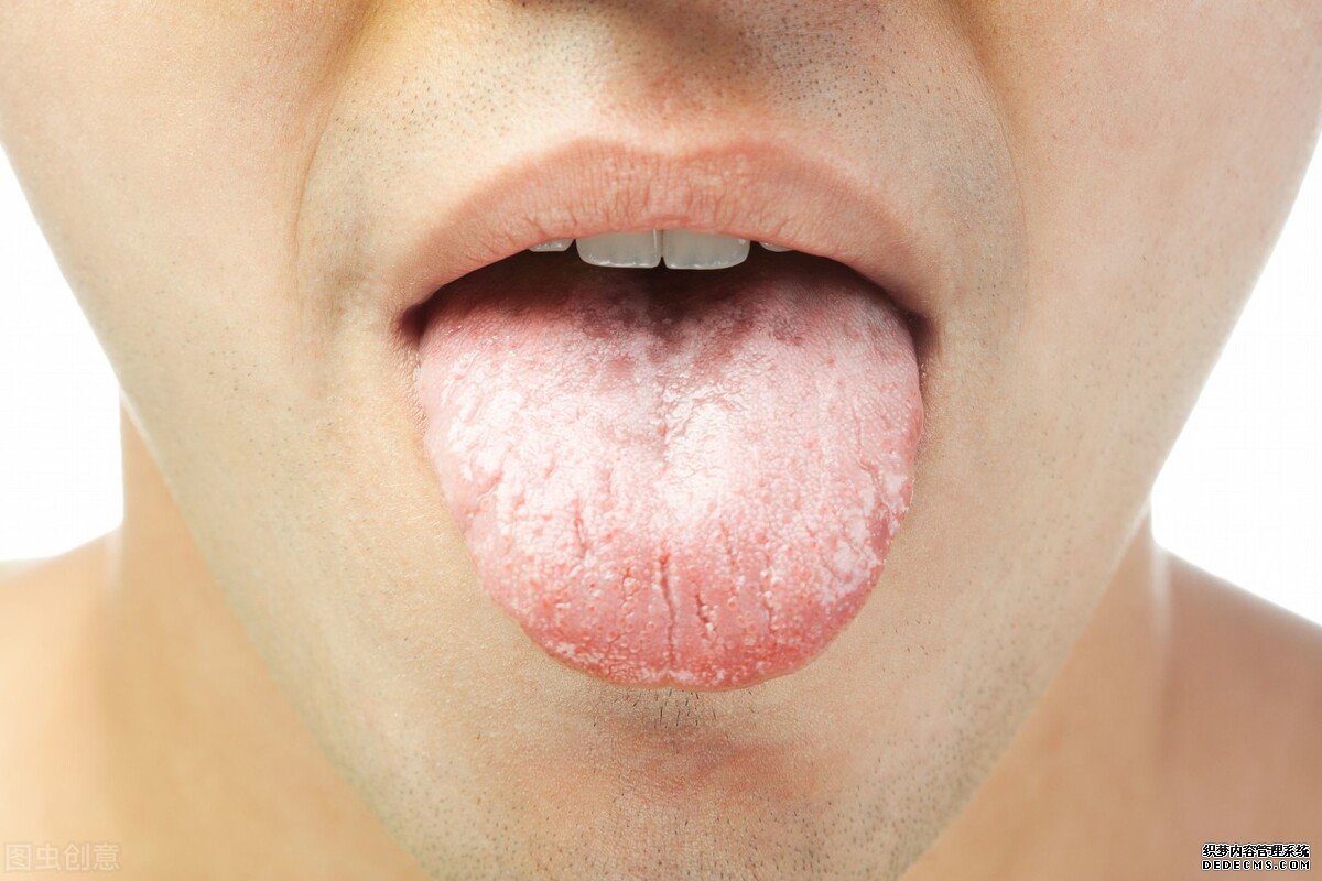 中药搭配食疗，这四种方法可以帮你去口臭