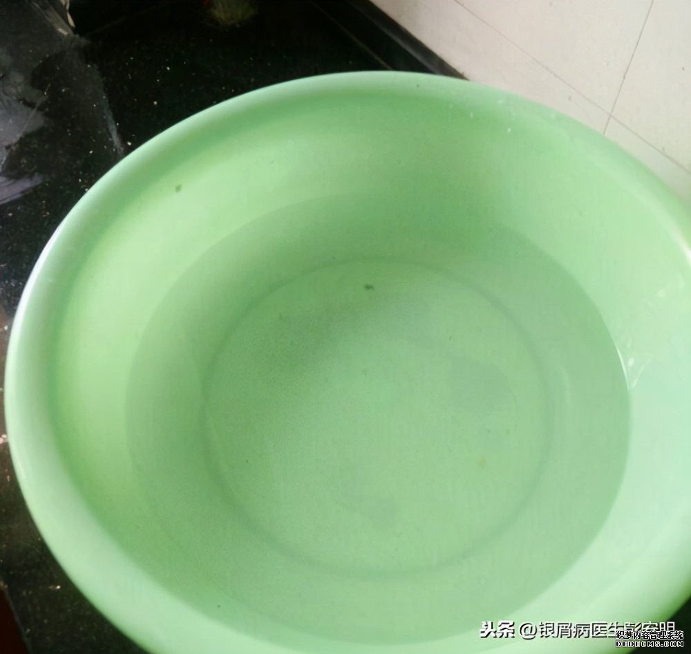 冬天是银屑病患者的克星?按照这6点来,这个冬天不难过