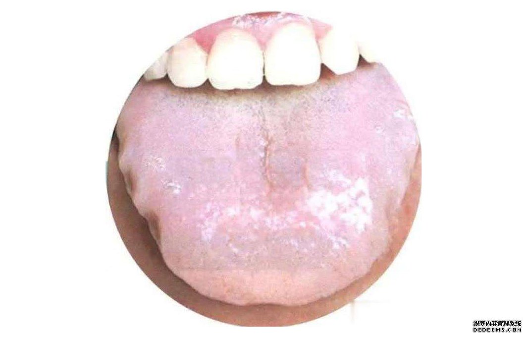 看舌头,知全身?自己是什么体质,体内是否有疾,伸舌一看便知