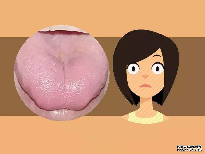 看舌头,知全身?自己是什么体质,体内是否有疾,伸舌一看便知
